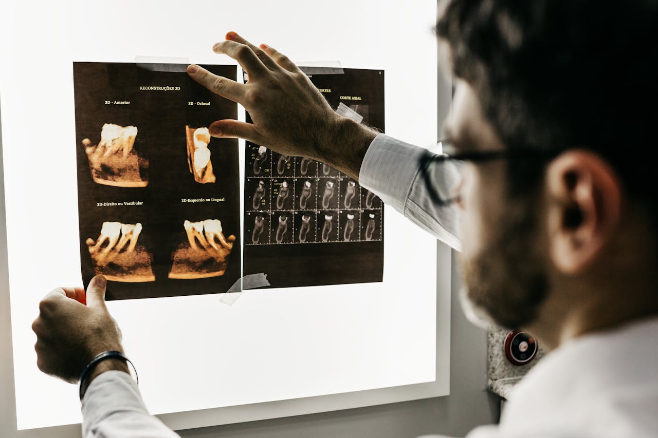 Crafting Captivating Headlines: Your awesome post title goes here Dentist analyzing dental x-rays to assess patient teeth health in a clinical setting.